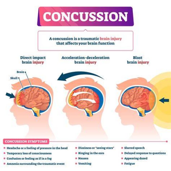 Can concussion symptoms show up 24 hours later?