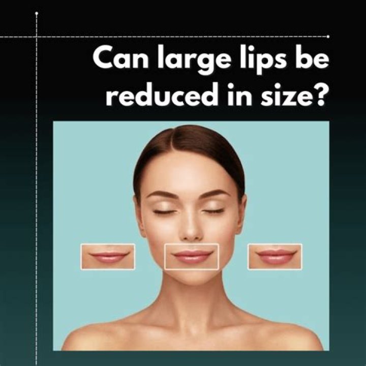 Can ear size be reduced?