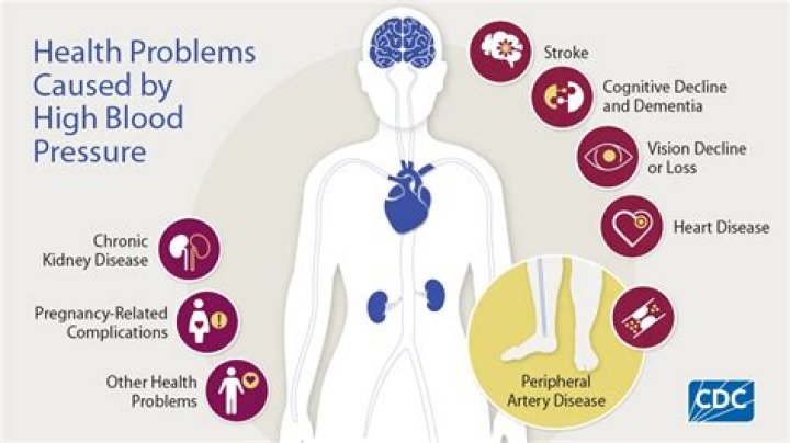 Can high blood pressure mimic dementia?