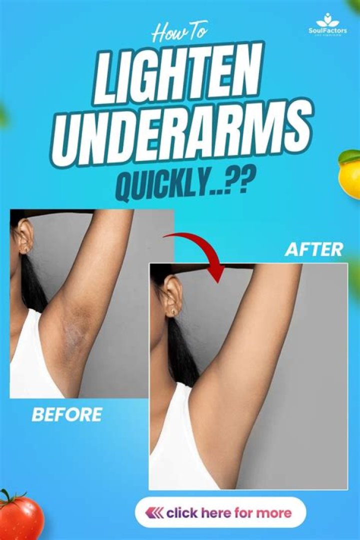 Can Vaseline lighten underarms?