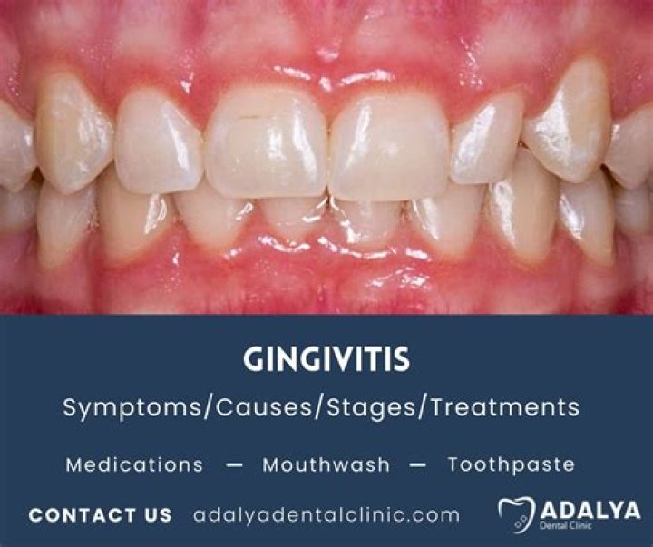 Can Waterpik get rid of gingivitis?