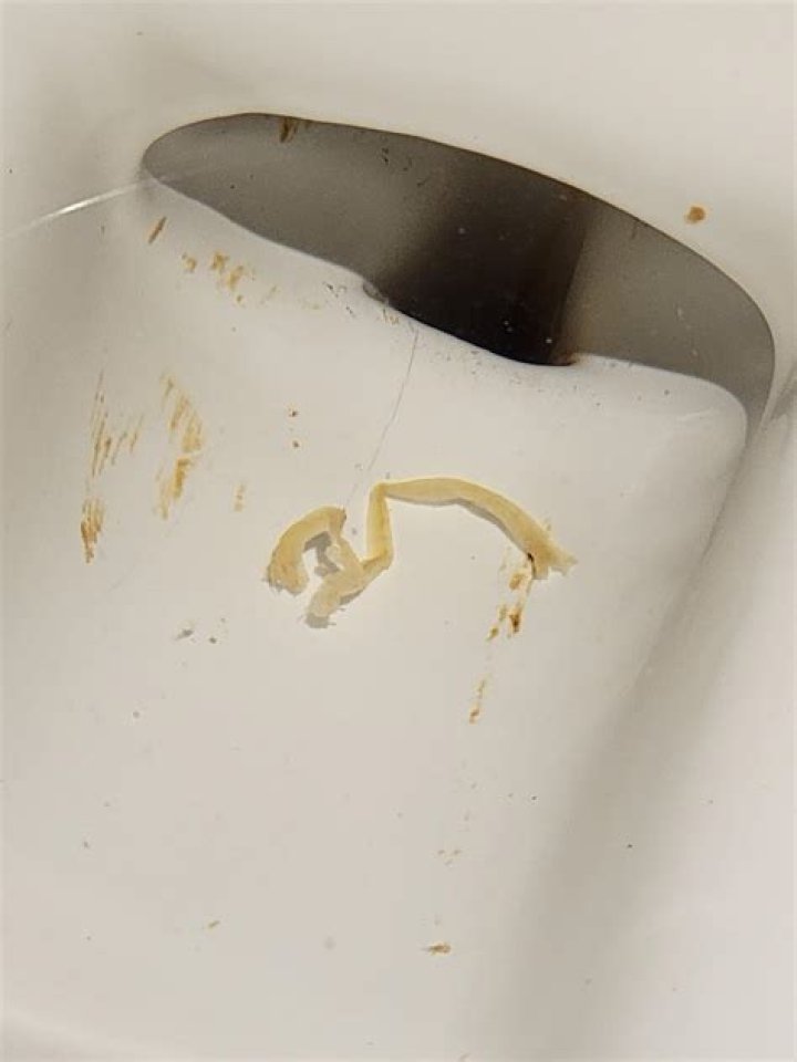 Can worms appear in the toilet?