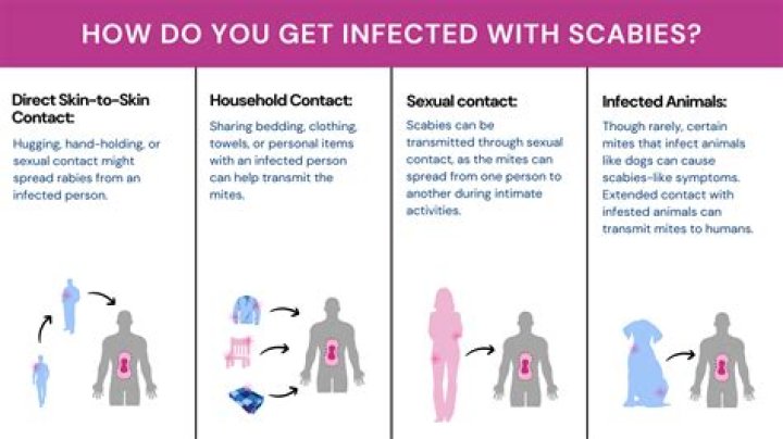 Can you get scabies without human contact?