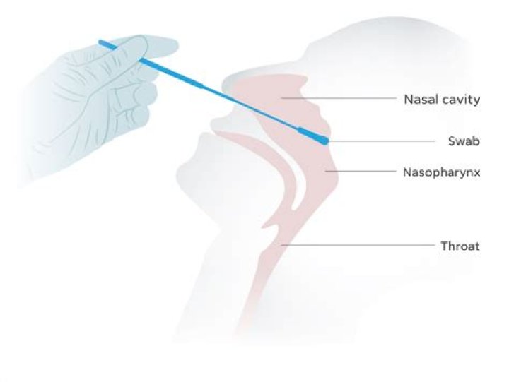 Do you have to swab nose and throat for Covid?