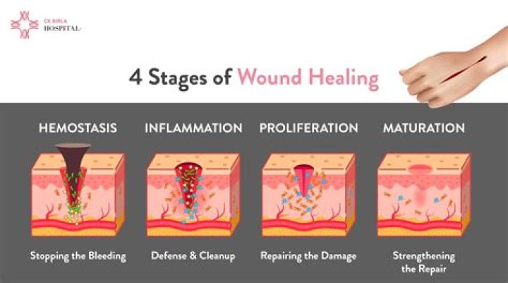 Does caffeine slow wound healing?