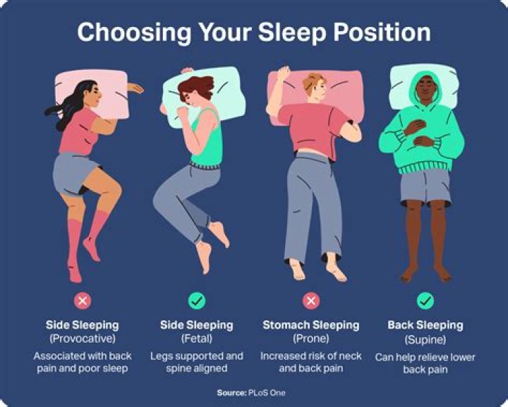 Does epilepsy make you sleep more?