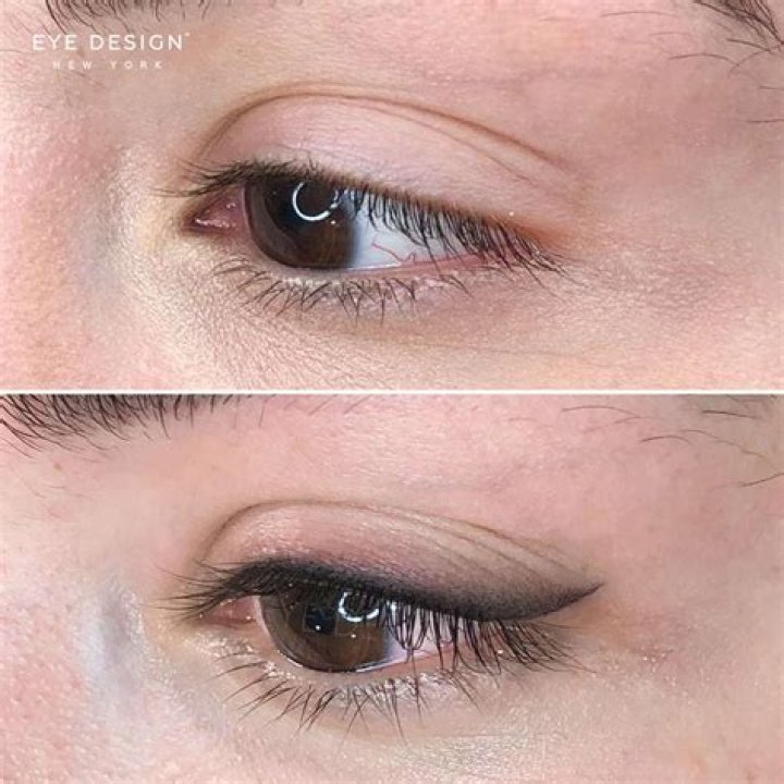 Does eyeliner make bags worse?