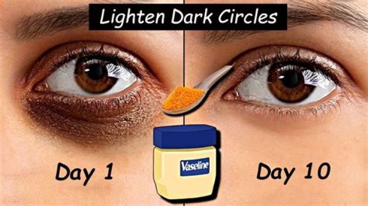 Does turmeric lighten dark circles?