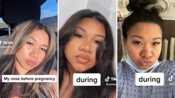 Does your nose get bigger after having a baby?