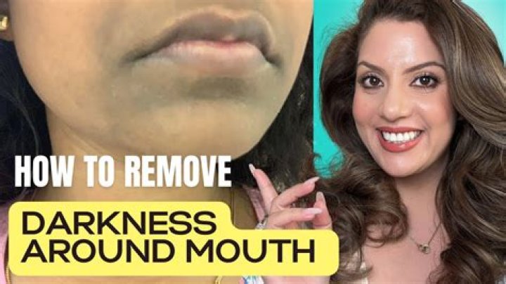 How can I get rid of darkness around my mouth naturally?