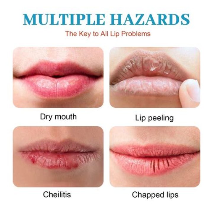 How can I keep my lips from turning black?