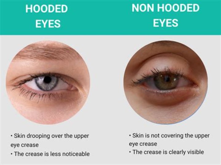 How can I lift my hooded eyes naturally?