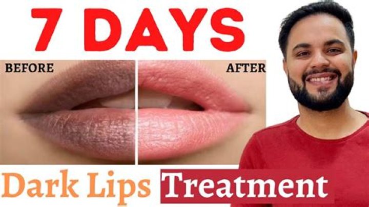 How do I fix my dark lips?