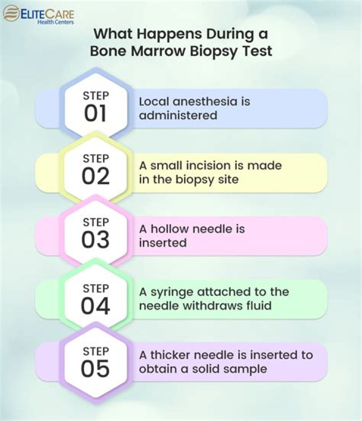 How long does a biopsy take to get results?
