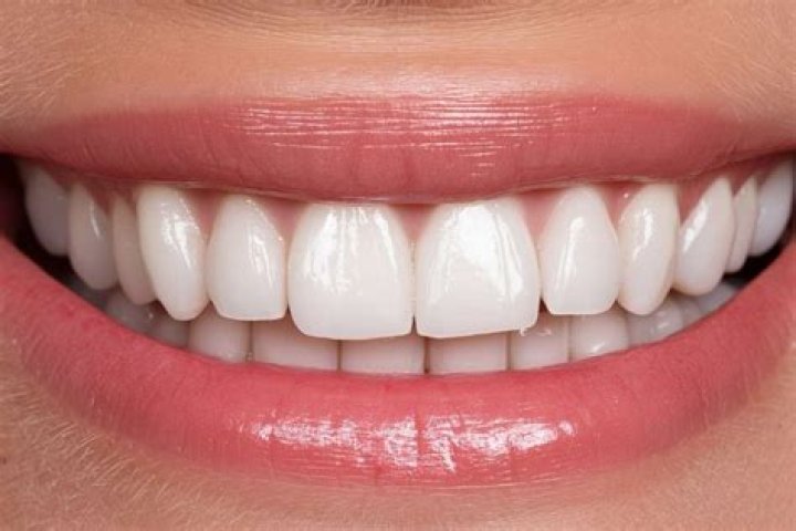 How long does it take for white spots on teeth to go away?