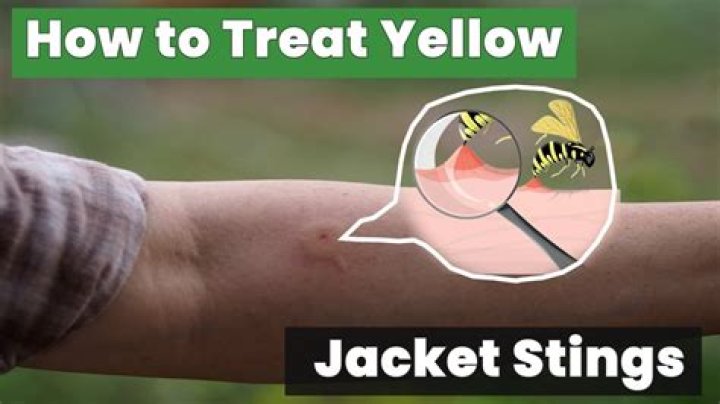 How many times can a yellow jacket sting you?