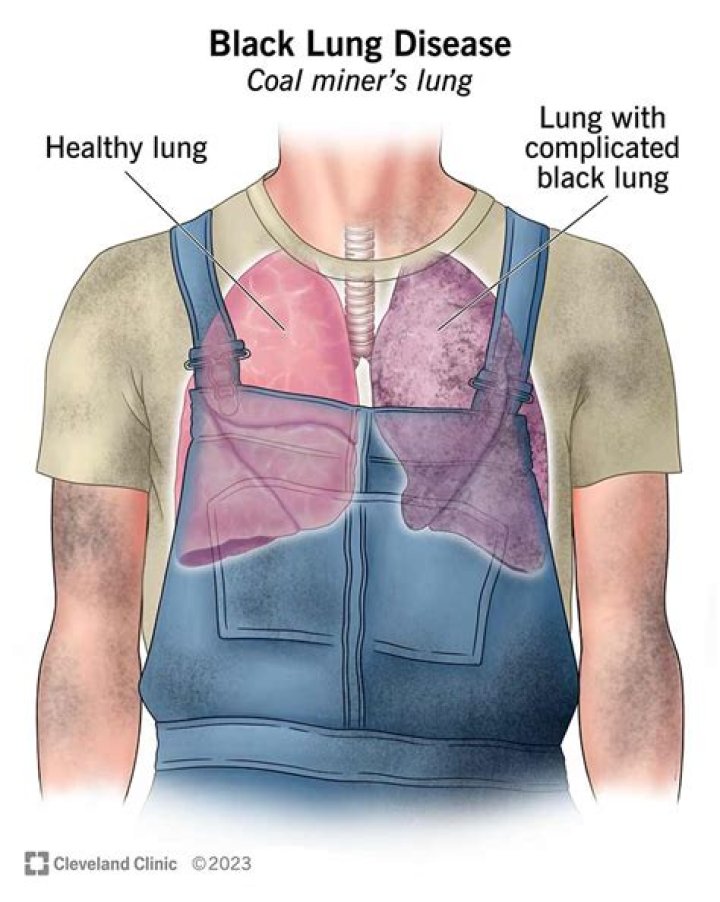 How much are black lung benefits?