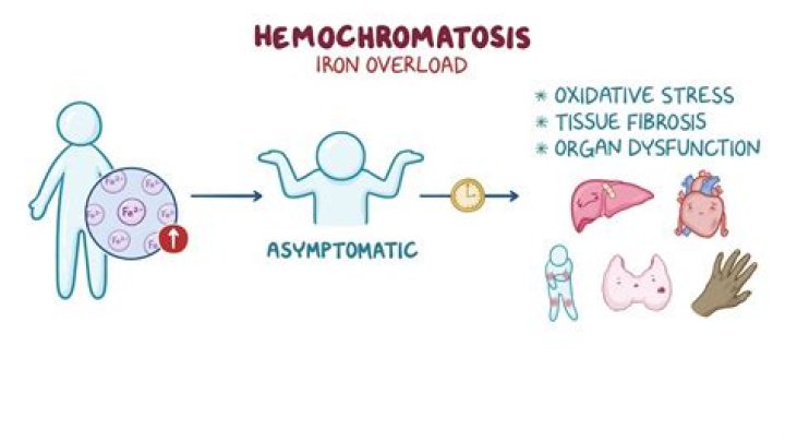 Is hemochromatosis a form of leukemia?