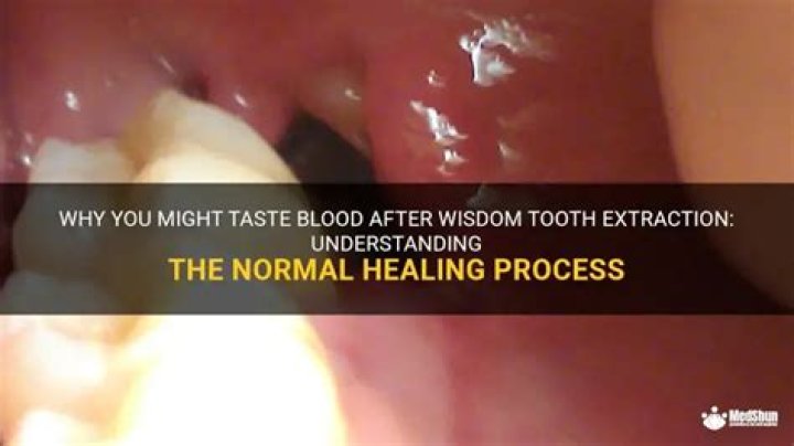 Is it normal to taste blood after wisdom teeth?
