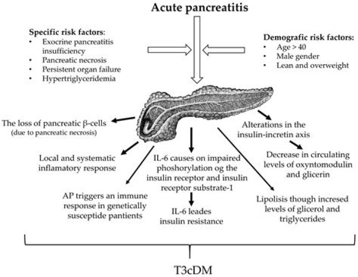 Is pancreatitis life threatening?