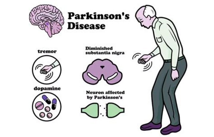 Is PSP worse than Parkinsons?
