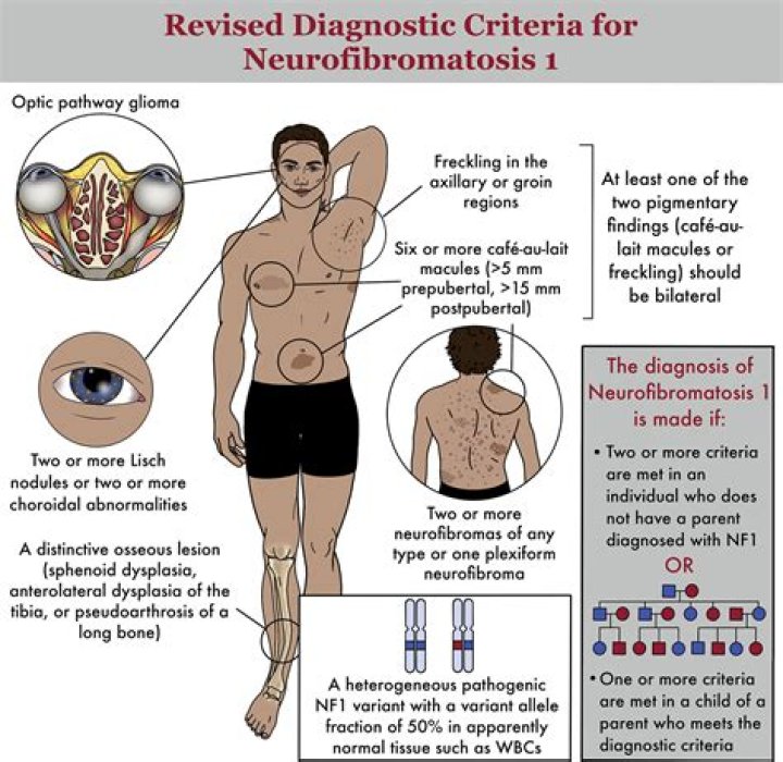 What's the difference between neurofibromatosis 1 and 2?