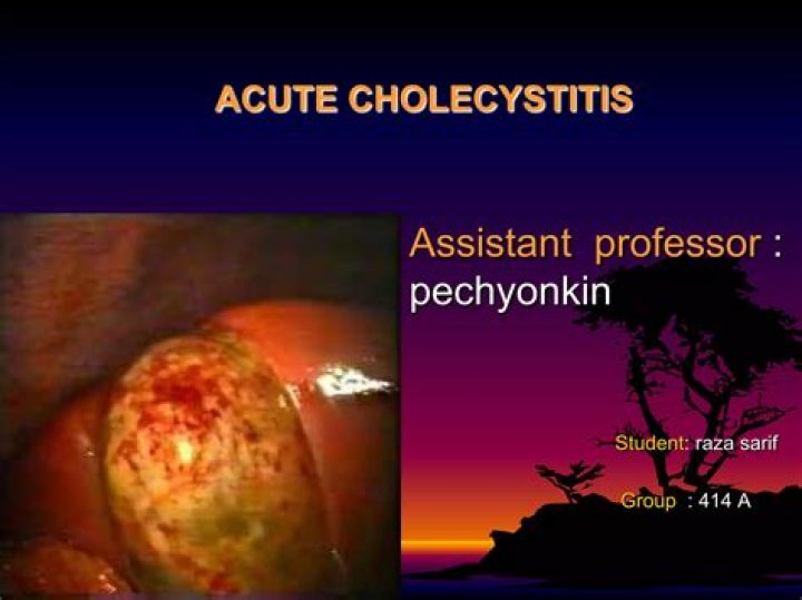 What are the complication of acute cholecystitis?