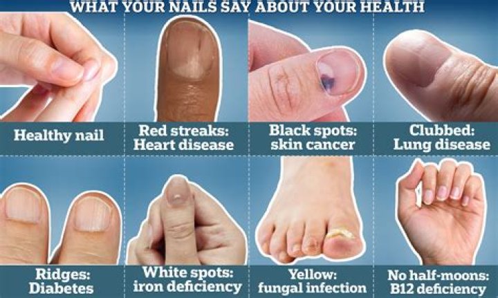 What do black nails say about you?