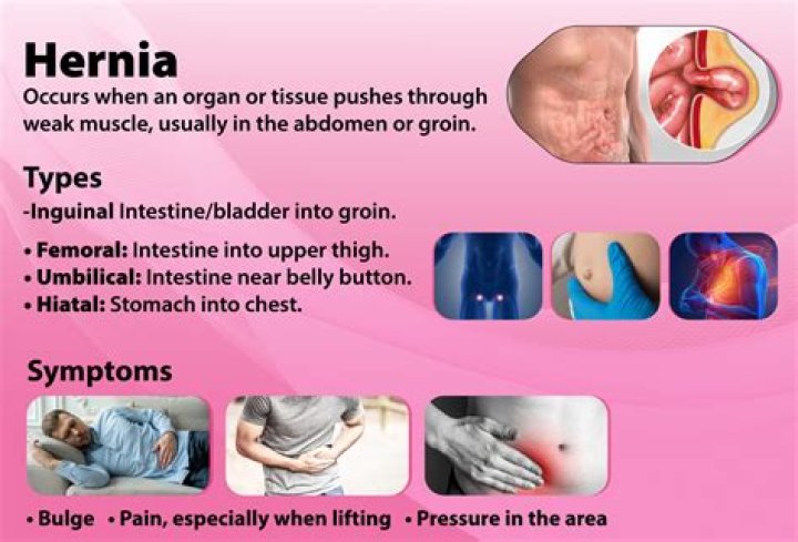 What does a hernia feel like in a woman stomach?