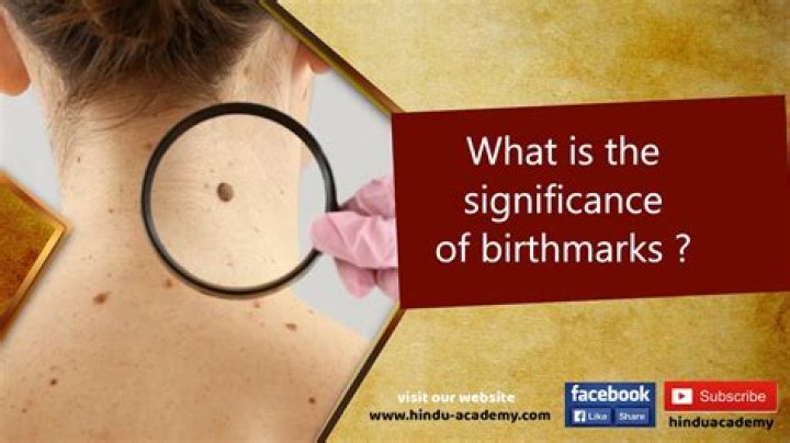 What does too many birthmarks mean?