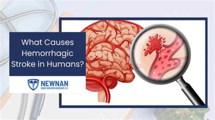 What is the most cause of stroke?