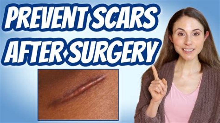 When can I start scar treatment after surgery?