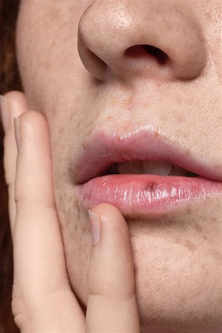 When should I be worried about leukoplakia?