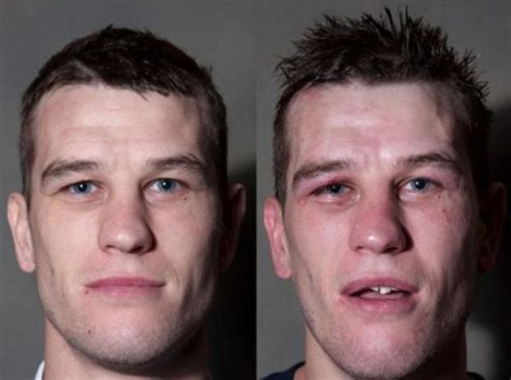 Why do boxers cut their eyes?