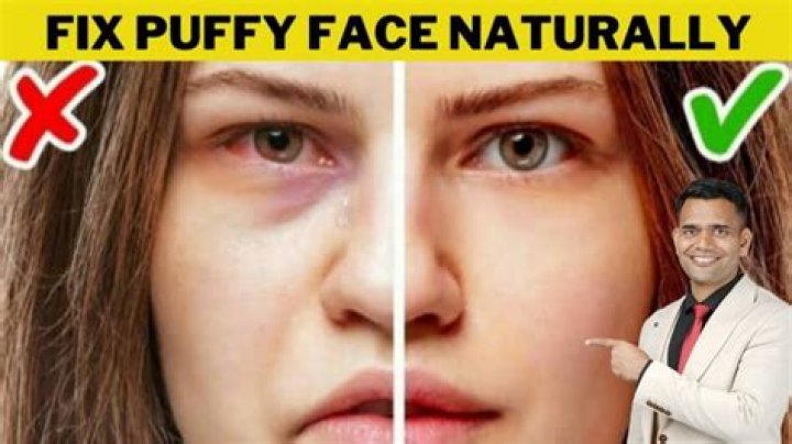 Why do celebrities have puffy faces?