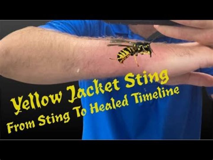 Why do yellow jackets sting for no reason?